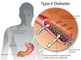 TYPE TWO DIABETES DEVELOPMENT